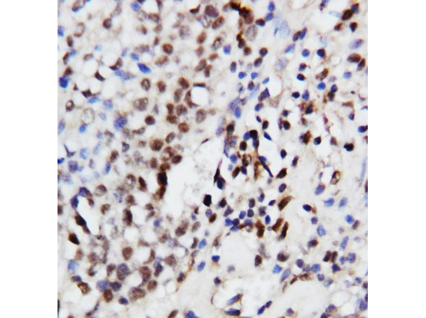 Immunohistochemistry of Anti-MAPK3/ERK1 antibody