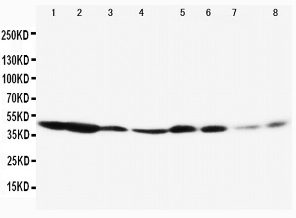 Western blotting of Anti-MAPK3/ERK1 antibody