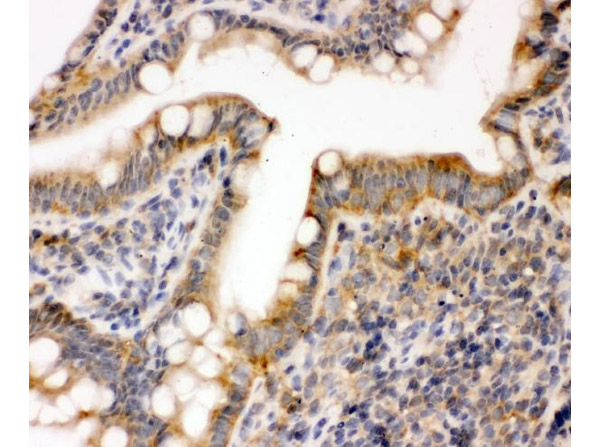 Immunohistochemistry of Anti-MAPK3/ERK1 antibody