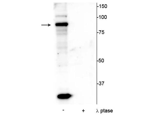 Western blot of anti-ATRIP pS239 antobdy