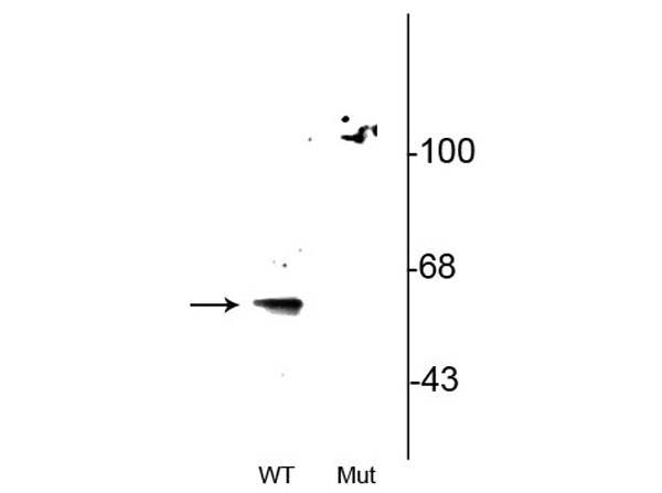 Western blot of Anti-Beclin 1 pS295 antibody