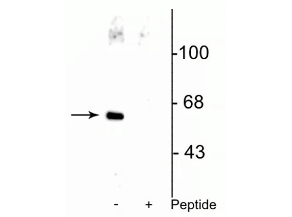 Western blot of Anti-Che-1 pS477 (AATF) Antibody