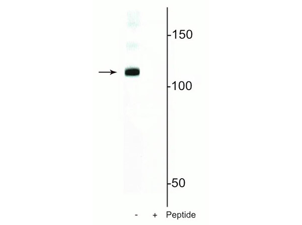 Western blot of Anti-DGCR8 pS377 antibody