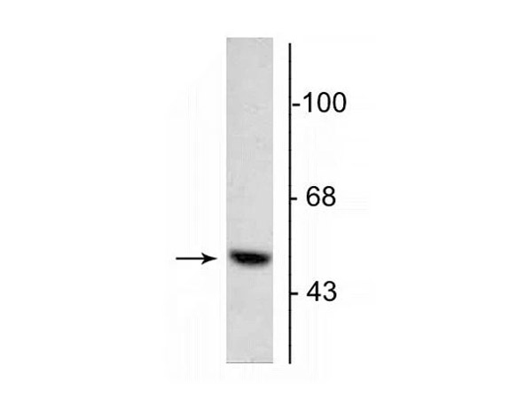 Western blot of Anti-DOPA antibody