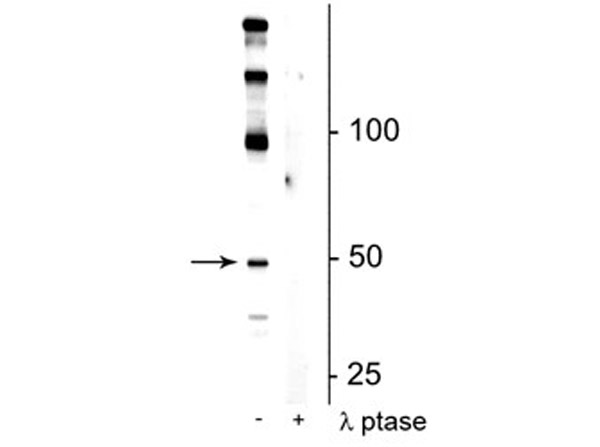 Western blot of Anti-EEF1A2 pS358 Antibody