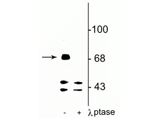 Western blot of anti-FMRP pS499 antibody