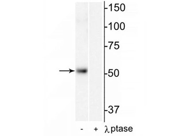 Western blot of anti-HDAC2 pS394 antibody