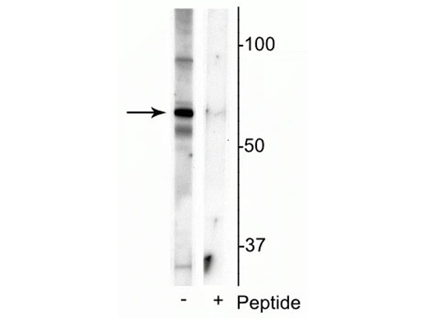 Western blot of Anti-MeCP2 pS421 Antibody