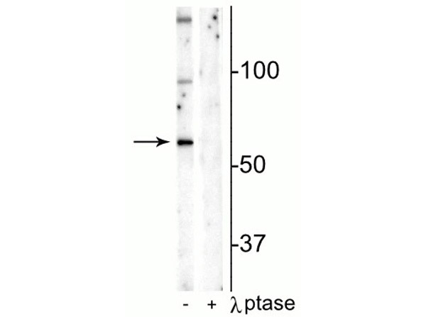 Western blot of Anti-Munc18-1 pS241 Antibody