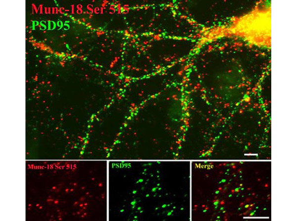 Immunostaining of Anti-Munc18 pS515 Antibody