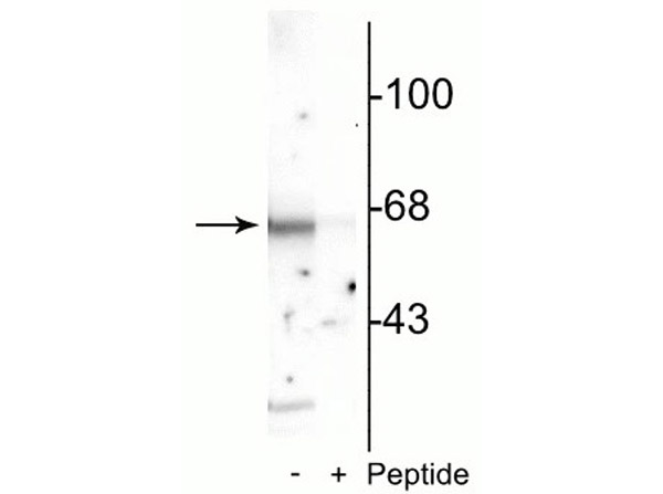 Western blot of Anti-Munc18 pS515 Antibody