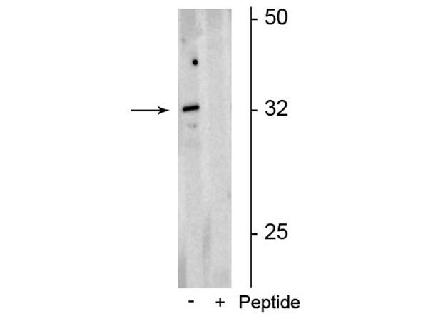 Western blot of Anti-Olig2 pS10/13/14 Antibody