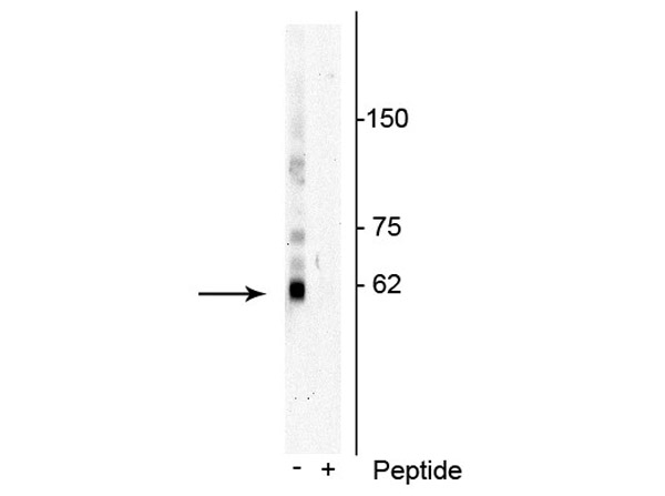 Western blot of Anti-p62 pT269/Ser272 Antibody