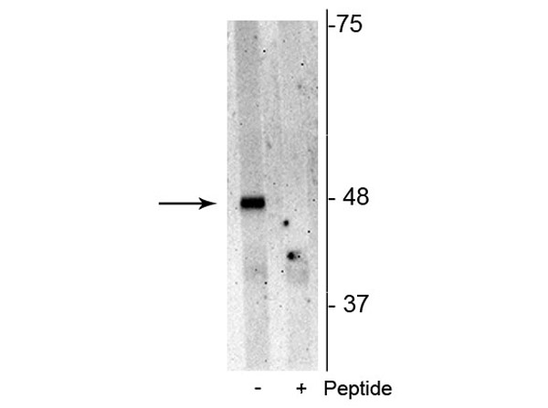 Western blot of Anti-p62 pS28 Antibody