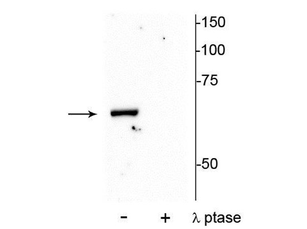 Western blot of Anti-PAK-1 pT84 Antibody.