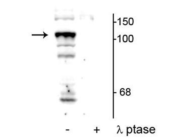 Western blot of Anti-PTPH1 pS459 Antibody