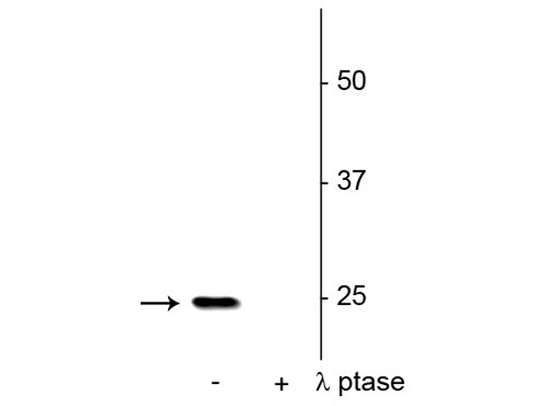 Western blot of Anti-SNAP25 pS187 Antibody