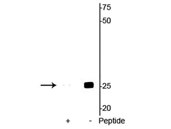 Western blot of Anti-Troponin I (cardiac) pS23/24 Antibody