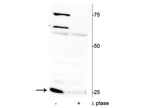 Western blot of Anti-Troponin I (cardiac) pS150 Antibody