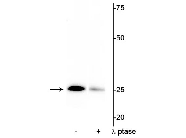 Western blot of Anti-Troponin I (cardiac) pS43 Antibody