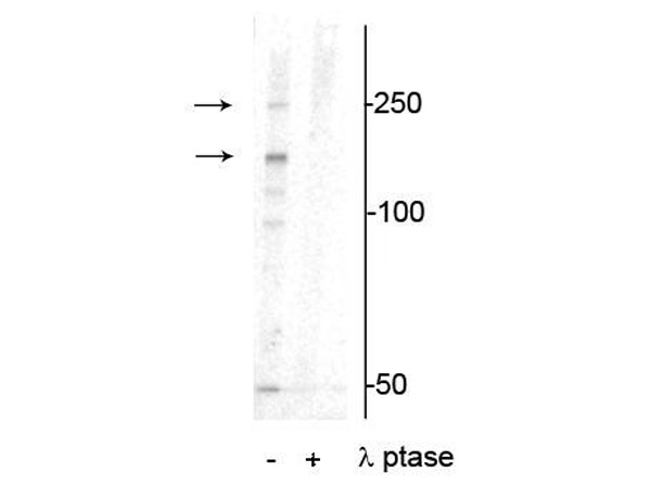 Western blot of Anti-Xin Actin-binding Repeat-containing Protein 1 pS295 (XIRP1) Antibody