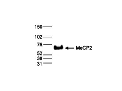 Western Blot results of Rabbit anti-MeCP2 antibody