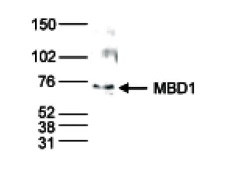 Western Blot results of Rabbit anti-MBD1 antibody