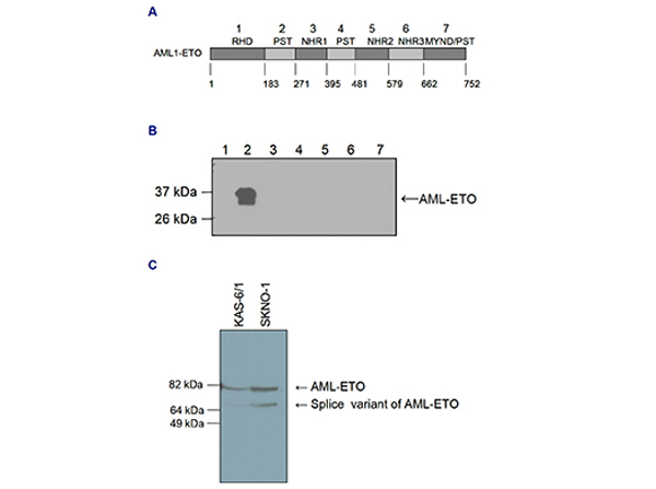 Western blot analysis using Anti-AML-ETO