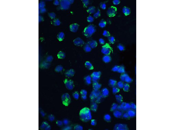 Immunofluorescence of 4E-BP1