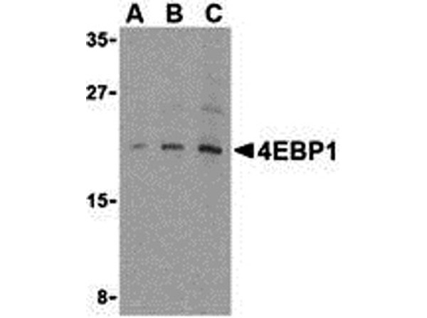 Western blot of 4E-BP1