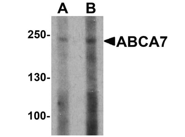 Western Blot of ABCA7 Antibody