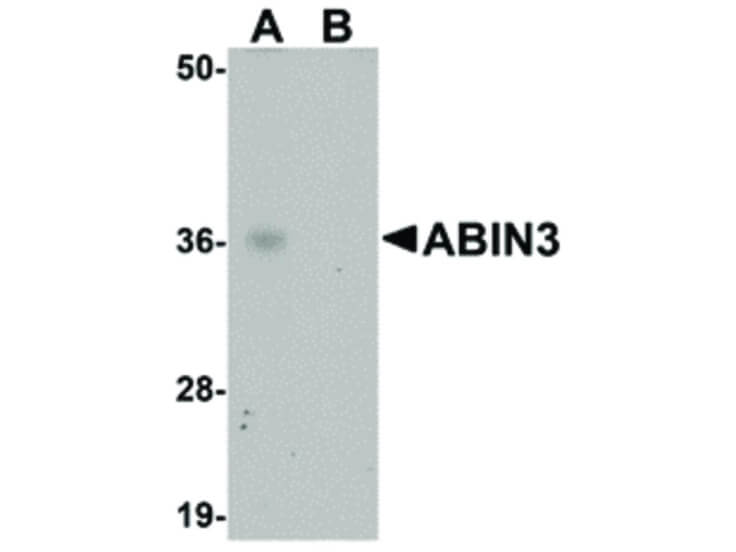 Western Blot of ABIN3 Antibody