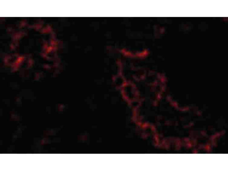 Immunofluorescence of ACE2 Antibody