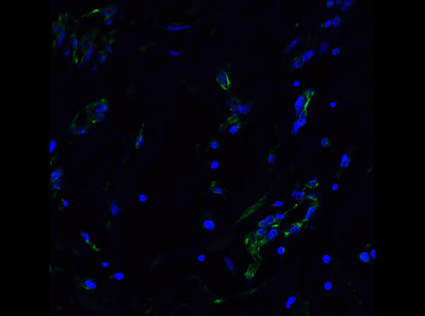 Immunofluorescence of Rb Anti-ACE2 Antibody