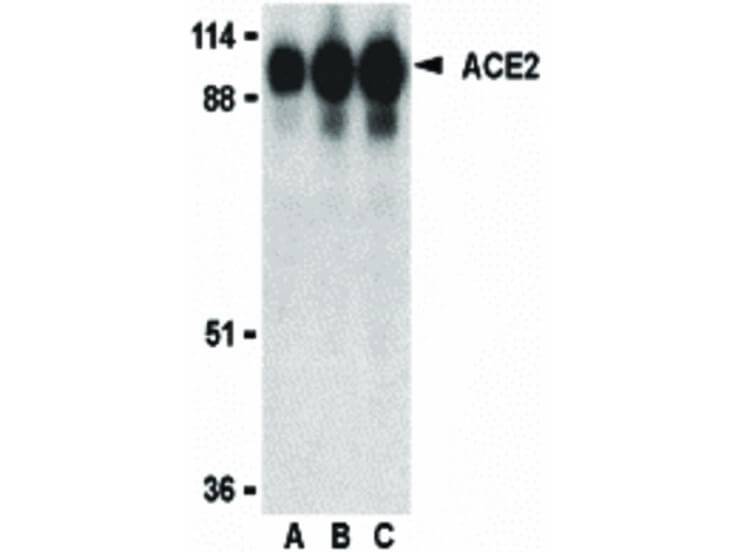 Western Blot of ACE2 Antibody
