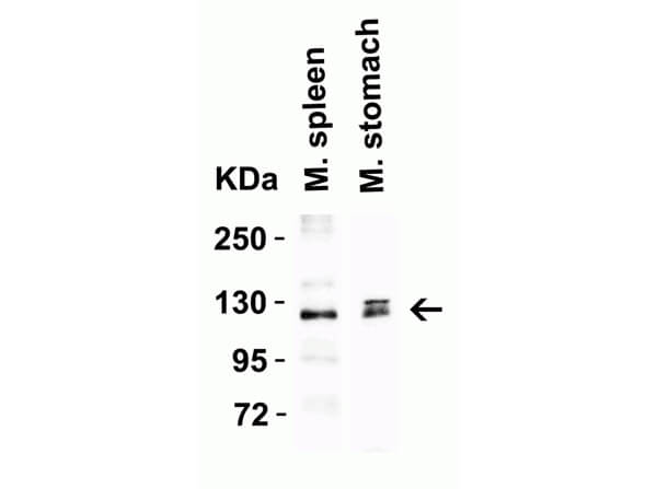 Western Blot of Anti-ACE2 Antibody