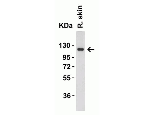 Western Blot of Rb Anti-ACE2 Antibody