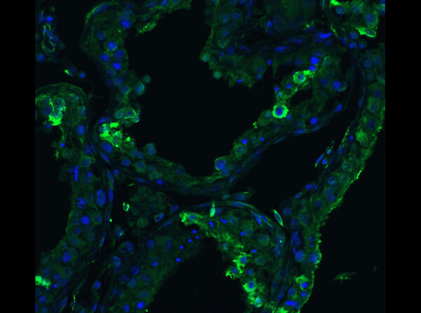 Immunofluorescence of Rabbit Anti-ACE2 Antibody