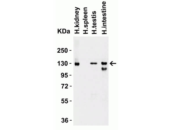 Western Blot of Rabbit anti-ACE2 Antibody