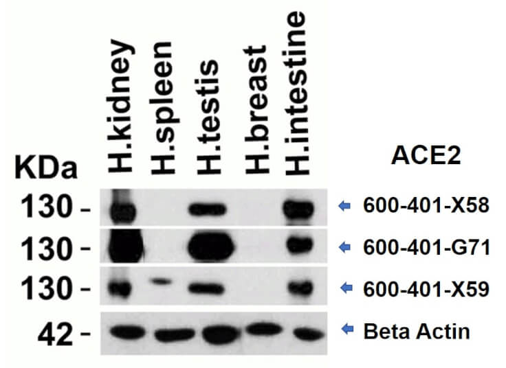 Western Blot of different Anti-ACE2 Antibodies