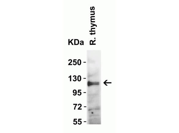 Western Blot of Rb Anti-ACE2 Antibody