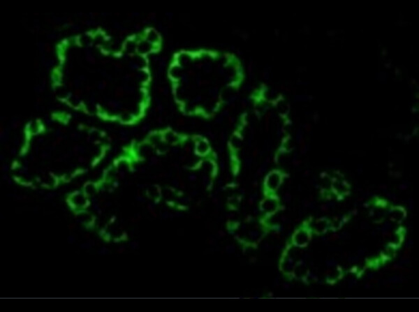 Immunofluorescence of Rabbit Anti-ACE2 Antibody.