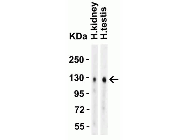 Western Blot of Rabbit Anti-ACE2 antibody