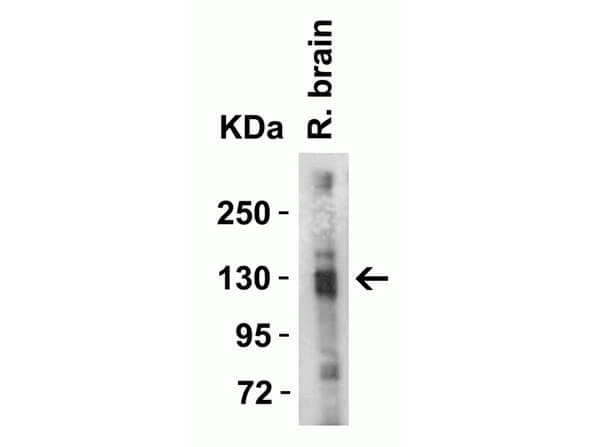 Western Blot of Anti-ACE2 antibody