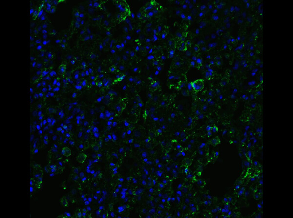 Immunofluorescence of Rabbit ACE2 Antibody