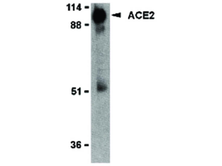 Western Blot of ACE2 Antibody