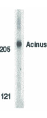 Western Blot of Acinus Antibody