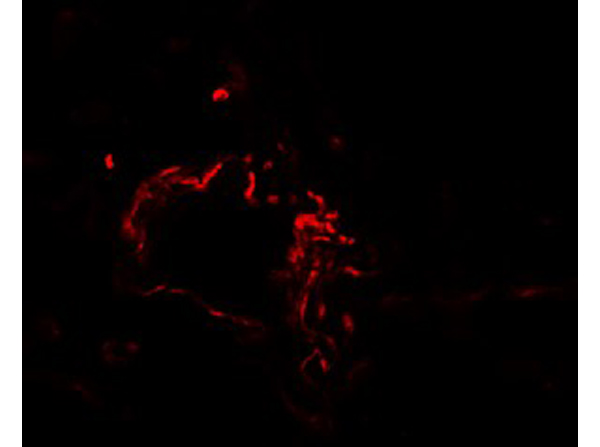 Immunofluorescence of ACSL1