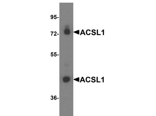 Western blot analysis of ACSL1