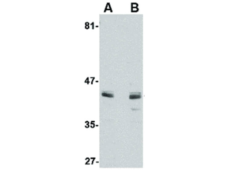 Western Blot of ACVR1 Antibody